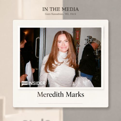 Meredith Marks Facelift by Dr. Garo Kassabian