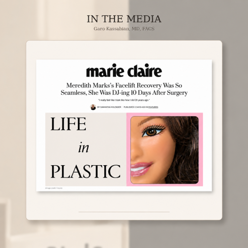 Meredith Marks Facelift by Dr Garo Kassabian