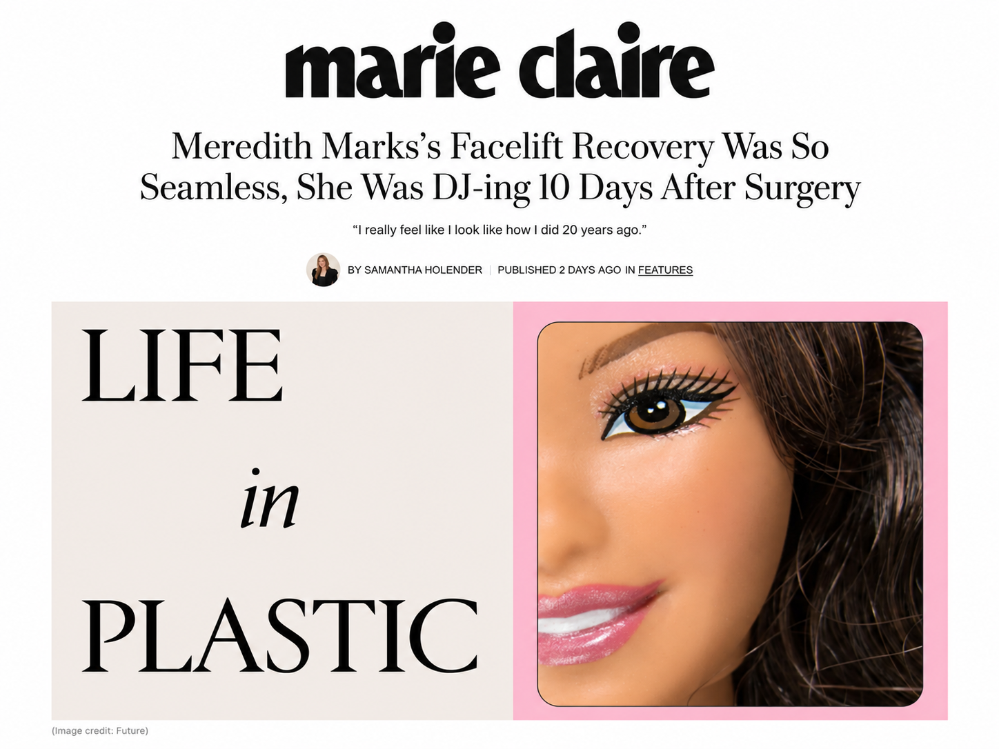Meredith Marks Facelift by Dr. Garo Kassabian in Marie Claire